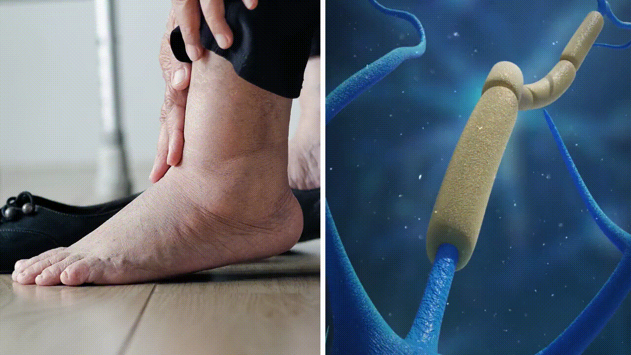 Nerve healing process