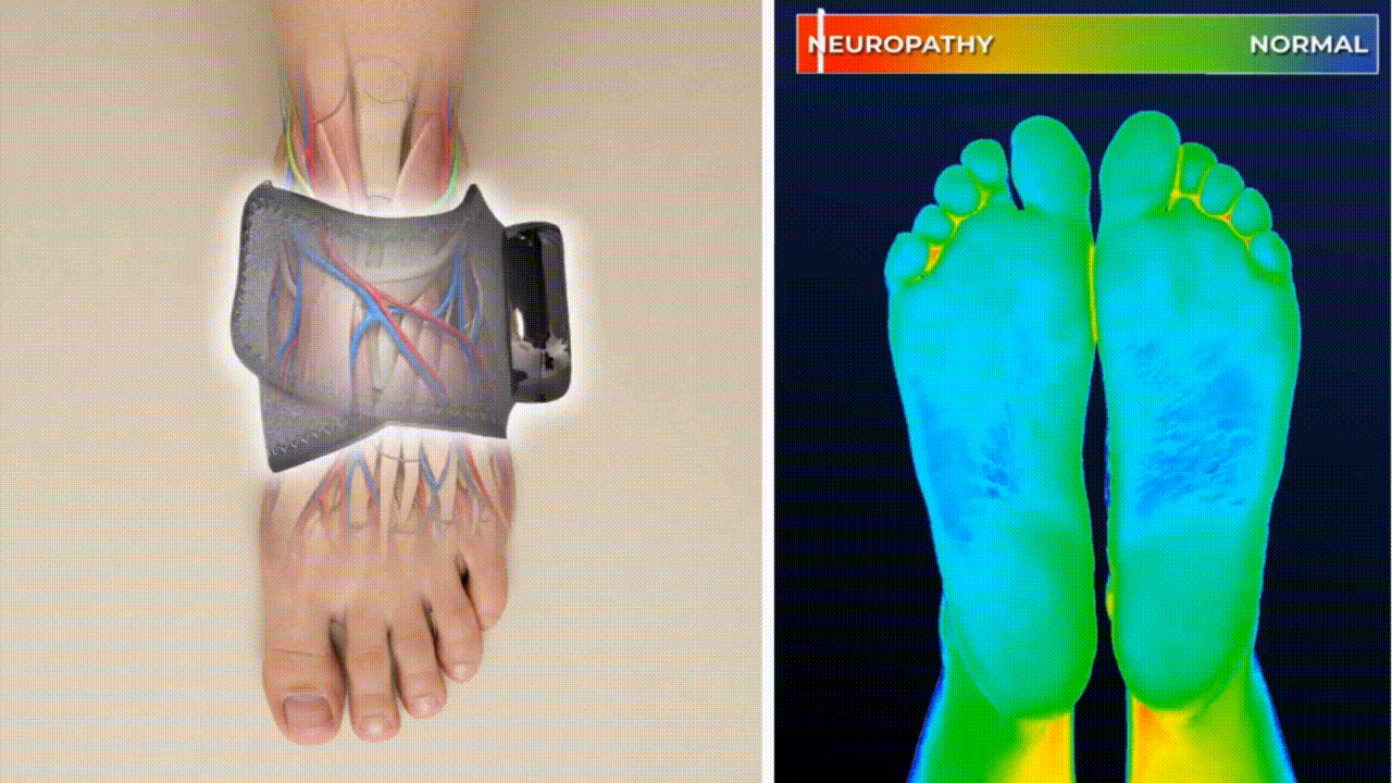 Ankalax massager in action